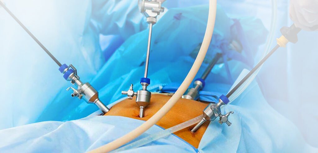 laparoscopic surgeon in noida