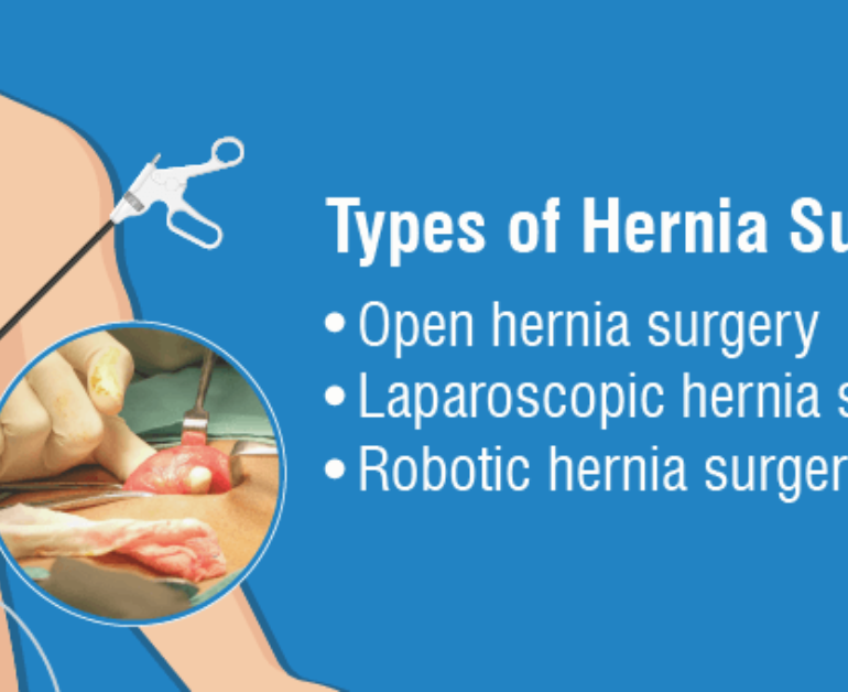 hernia surgery in Noida