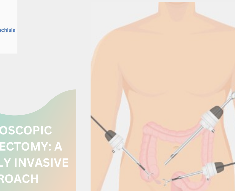 Laparoscopic Appedicectomy