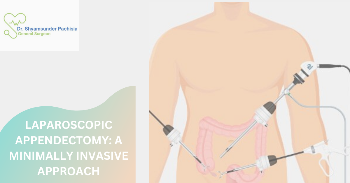 Laparoscopic Appedicectomy